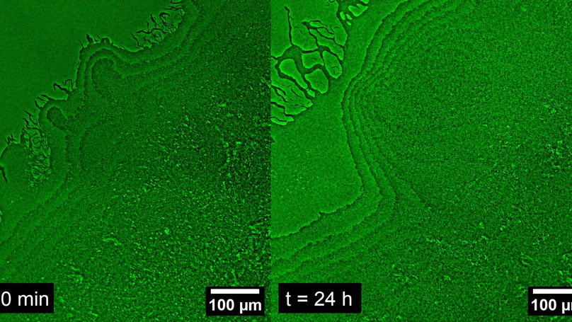 🦠 "Rush hour on Agar Avenue."